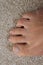 Sore skin on feet dry dehydrated feet of a lady ,five toes with clean skin