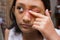 Southeast Asian ethnicity teenage girl annoyed with itchy skin disease, dermatitis problem on her face around the eye and nose,