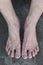 Southeast Asian, Myanmar old womanâ€™s foots of dorsal view. Skin creases, loosen skin and veins show aging