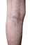 Southeast Asian, Myanmar old womanâ€™s leg. Skin creases, loosen and thin skin and varicose veins show aging