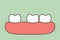 Spacing teeth diastema, dental problem