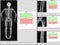 Special exam results bone density.too blurriness and artifacting image