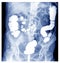 Special X-ray Barium Enema