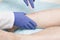 Specialist doctor conducts endovenous laser coagulation of the veins of the lower extremities. The concept of treatment for