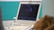 Specialist physician demonstrates the operation of a modern digital ultrasound. Exhibition of medical equipment and
