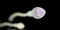 The sperm anatomy