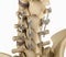 Spinal fixation system - titanium bracket.
