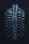 Spinal fracture. pins in the spine. thoracic spine. multiple myeloma myeloma. spine x-ray