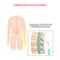 Spinal Tap Procedure. Detailed diagram of lumbar puncture