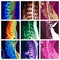 Spinal vertebrae pathology colorful collage