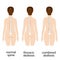 Spine deformation types and healthy spine comparison diagram poster .