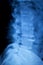 Spine hips Xray test scan