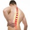 Spine Injury - Studio shot with 3D illustration isolated on whit