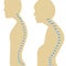 Spine kyphosis. Normal posture and kyphosis. Vector illustration on isolated background