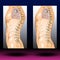 Spine Kyphosis - Spinal Cord - Human Anatomy - Healthcare - Science
