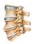 Spine - Lumbar Osteoarthritic and Spondylitic Arthritis