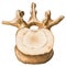 Spine - Lumbar Vertebra