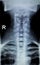 Spine neck Xray test scan