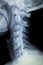 Spine neck Xray test scan