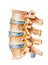 Spine - Nerve Irritation