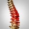 Spine Pain