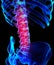 Spine painful skeleton x-ray, 3D illustration.