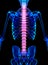 Spine painful skeleton x-ray, 3D illustration.