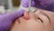 Squeezing acne from from female problem skin in salon with loop. Beautician making face mechanical cleaning