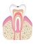 Stage of caries development. Tooth structure in flat style. Tooth decay with enamel. Dental disease realistic vector