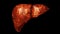Stage of a Liver to the patient because of diseases like greasy, liver fibrosis, cirrhosis, hepatitis and cancer