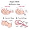 Stages of baby birth infographic diagram