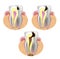 THE STAGES OF CARIES DEVELOPMENT