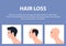 Stages of male baldness. Hair loss. Alopecia.