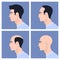 Stages of male pattern baldness. Hair loss. Alopecia.