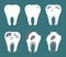 Stages of tooth decay