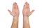 Stains from vitiligo disease on the inside of the hands and forearms of a young Caucasian woman, isolated on a white background w