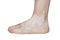 Stains from vitiligo disease on the left foot in a young Caucasian woman, isolated on a white background with a clipping path.