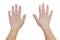 Stains from vitiligo disease on the outer parts of the hand of a young Caucasian woman, isolated on a white background with a clip