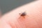 Starved Tick Seeking Right Place on Host Body