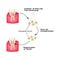 Stem cells from the dentin of the tooth is used to regenerate diseased tooth dentin. Infographics. Vector illustration