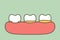 Step of plaque or tartar , cause of tooth periodontal disease