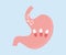 Stomach with pills logo design. Human stomach close up. Organ anatomy. Digestive system. Ulcer, cancer, gastritis, dysbiosis.