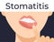 Stomatitis woman lips