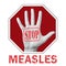 Stop measles conceptual illustration. Open hand with the text stop measles