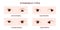 Strabismus types. Hypotropia, hypertropia, exotropia, esotropia. Human eyes with different squint disorders. Crossed