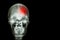 Stroke ( Cerebrovascular accident ) . film x-ray skull of human with red area ( Medical , Science and Healthcare concept and backg