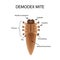 The structure of the demodex mite. Demodecosis. Infographics. Vector illustration on background.