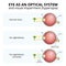 structure of the eyeball, visual impairment, farsightedness