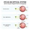 structure of the eyeball, visual impairment, near-sightedness