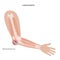 Student elbow bursitis